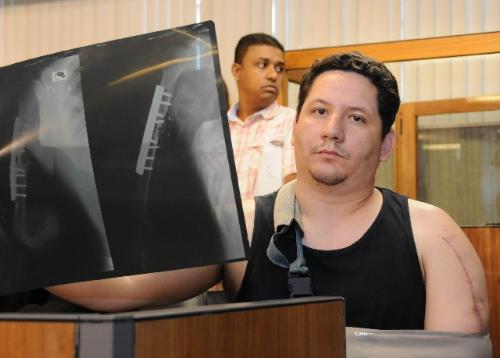 João Alcides foi baleado, teve seu braço mutilado e sofreu fraturas expostas